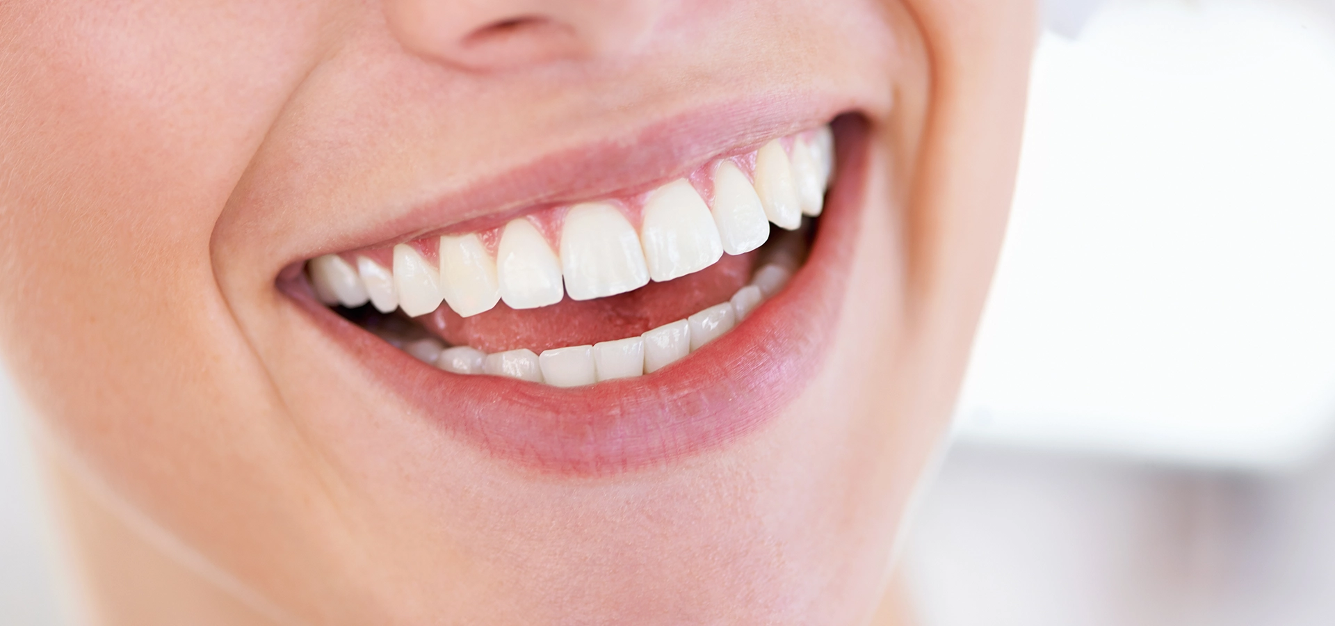 Primer plano de una sonrisa tras una endodoncia.