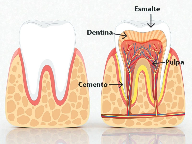 Iconografía de pulpitis dental.