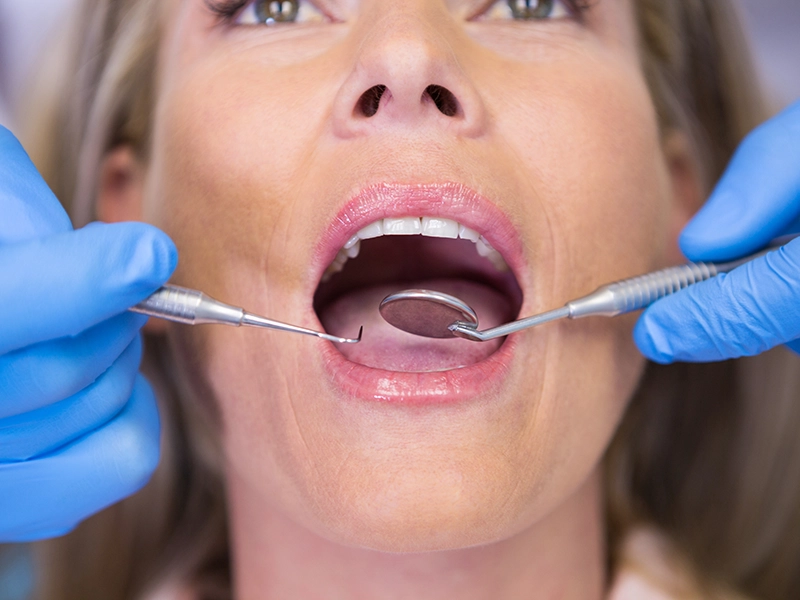 Una mujer en una revisión del dentista.