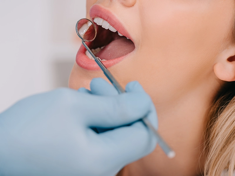 Revisión dental.
